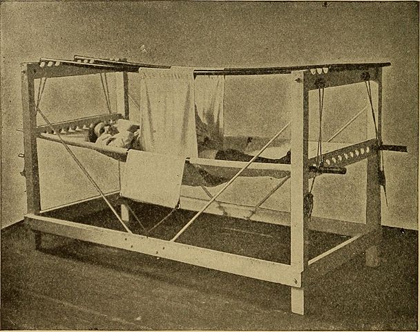 Patient in a symphysiotomy hammock after surgery, 1907 (Photo: Wikimedia/Flickr/The Library of Congress)