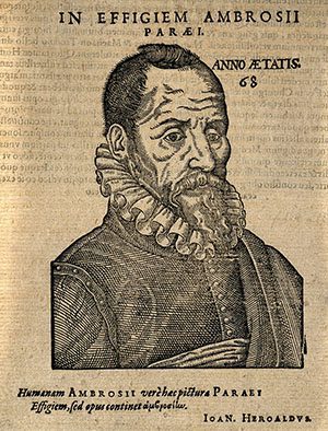 Ambroise Paré. Woodcut, 1612. Paré is considered one of the fathers of surgery and modern forensic pathology. He was the first person to introduce a hinged prosthetic hand and a leg with a locking knee joint. (Image: Science Museum, London)
