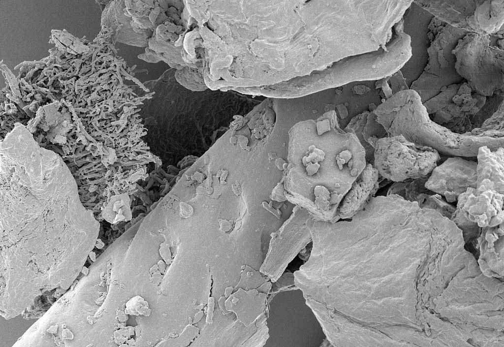 House dust under high magnification. (Photo: Wikimedia/NIAID)