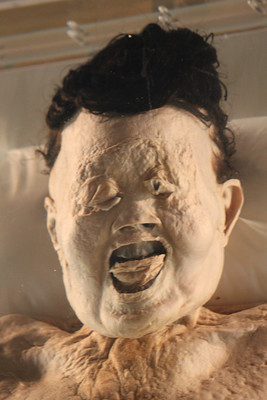 The mummified head of Lady Dai, on display at the Hunan Provincial Museum, Changsha, China.